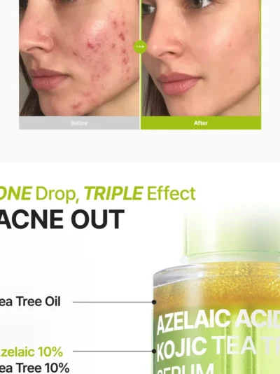 Purito Azelaic Acid 10% + Kojic Acid + Tea Tree Facial Serum - Image 4